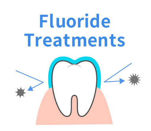 Effect of fluorine treatment Toothed character Dental illustration