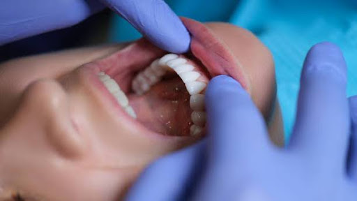 Doctor dentist examining patient oral cavity with veneers