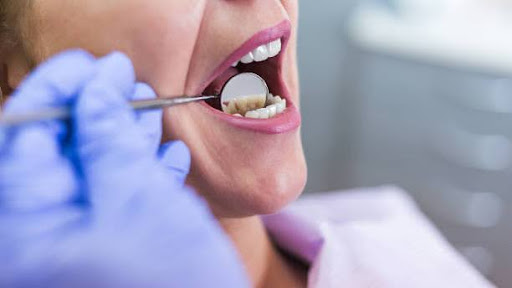 Open female mouth during oral checkup at the dentist. Selective focus